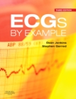 Image for ECGs by Example