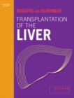 Image for Transplantation of the Liver