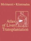 Image for Atlas of Liver Transplantation