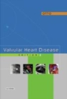 Image for Valvular Heart Disease