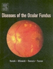 Image for Diseases of the Ocular Fundus