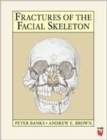 Image for Fractures of the Facial Skeleton