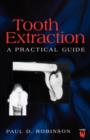 Image for Tooth extraction  : a practical guide