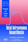 Image for Total intravenous anaesthesia