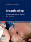 Image for Breastfeeding  : an illustrated guide to diagnosis and treatment