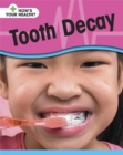 Image for Tooth decay