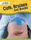 Image for Cuts, Bruises and Breaks