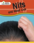Image for Nits and head lice