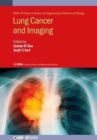 Image for Lung Cancer and Imaging