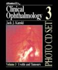 Image for Clinical Ophthalmology : A Systemic Approach : v.3 : Uveitis and Tumours