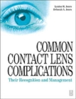 Image for Common Contact Lens Complications