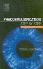 Image for Phacoemulsification  : step by step