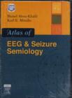Image for Atlas of EEG and Seizure Semiology