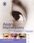 Image for Asian Blepharoplasty and the Eyelid Crease