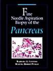 Image for Fine needle aspiration biopsy of the pancreas