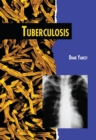 Image for Tuberculosis (Revised Edition)