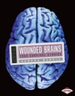 Image for Wounded brains: true survival stories