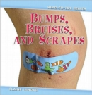 Image for Bumps, Bruises and Scrapes
