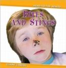 Image for Bites and Stings