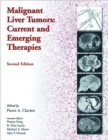 Image for Malignant Liver Tumors : Current and Emerging Therapies