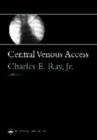 Image for Central Venous Access