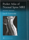 Image for Pocket Atlas of Spinal MRI