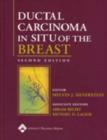 Image for Ductal Carcinoma in Situ of the Breast