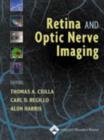 Image for Retina and Optic Nerve Imaging