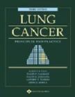 Image for Lung Cancer