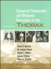 Image for Computed Tomography and Magnetic Resonance of the Thorax