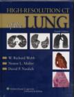 Image for High-resolution CT of the Lung