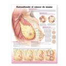 Image for Understanding Breast Cancer Spanish : Entendiendo El Cancer De Mama