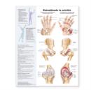 Image for Understanding Arthritis Spanish : Entendiendo la artritis
