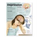 Image for Understanding Depression Anatomical Chart