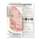 Image for Understanding Lung Cancer Anatomical Chart