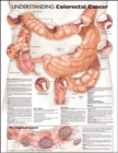 Image for Understanding Colorectal Cancer Anatomical Chart