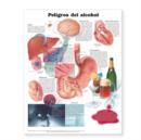 Image for Dangers of Alcohol Anatomical Chart in Spanish (Peligros del alcohol)