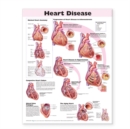 Image for Heart Disease Anatomical Chart