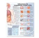 Image for Sexually Transmitted Infections Anatomical Chart in Spanish (Infecciones de transmision sexual)