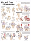Image for Hip and Knee Inflammations Anatomical Chart