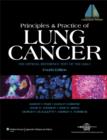 Image for Principles and practice of lung cancer  : the official reference text of the IASLC