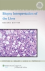 Image for Biopsy Interpretation of the Liver