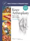 Image for Knee arthroplasty