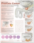 Image for Understanding Prostate Cancer Anatomical Chart