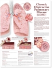 Image for Chronic Obstructive Pulmonary Disease Anatomical Chart