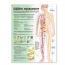 Image for Understanding Diabetic Neuropathy Anatomical Chart