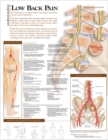 Image for Understanding Low Back Pain Anatomical Chart