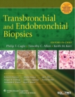 Image for Transbronchial and endobronchial biopsies