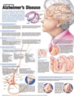Image for Understanding Alzheimer&#39;s Disease Anatomical Chart