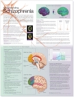 Image for Understanding Schizophrenia Anatomical Chart